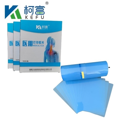 Imagen médica de PET seco de inyección de tinta película azul de rayos X médica de película de tamaño personalizado