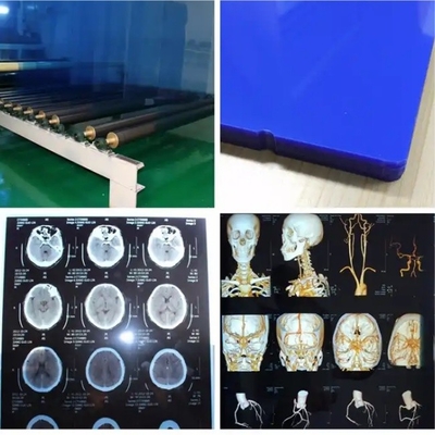 Película térmica de rayos X médica a prueba de agua Película azul de rayos X para impresoras de inyección de tinta
