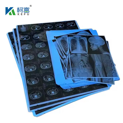 Imágenes médicas con película térmica / de inyección de tinta con rayos X basadas en PET azul para clínicas y hospitales