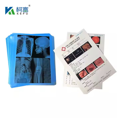 Película láser médica con alta precisión de color y fidelidad 14x18in 0.16mm para imágenes de diagnóstico reales a la vida