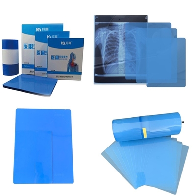 8x10 pulgadas 14x17 pulgadas película de rayos X azul médica sustituto Fuji película seca médica para clínicas y hospitales
