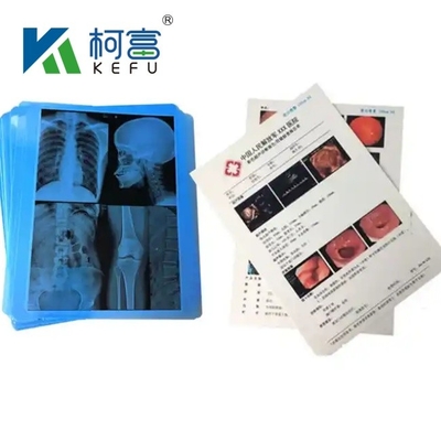 14&quot;*17&quot; Película de rayos X de alta calidad Película térmica seca azul médica para dispositivos médicos hospitalarios