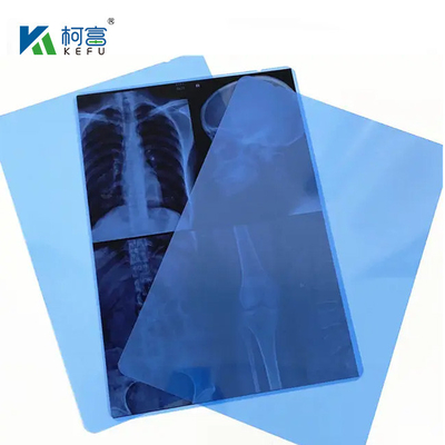 Película de escaneo seco de 14*17 pulgadas para radiografías médicas/CT/DR para impresoras de imágenes láser de rayos X y equipos de impresoras térmicas