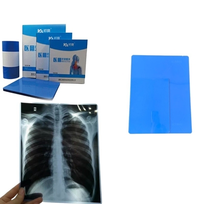 Hojas de tamaño A4 Película de rayos X de inyección de tinta azul para impresión de imágenes médicas Rayos X CT CR DR MTR PET