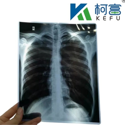 Muestra gratuita Imagen de película de papel de inyección de tinta de rayos X Impreso por impresora Para radiología diagnóstico médico Impresora 8 * 10