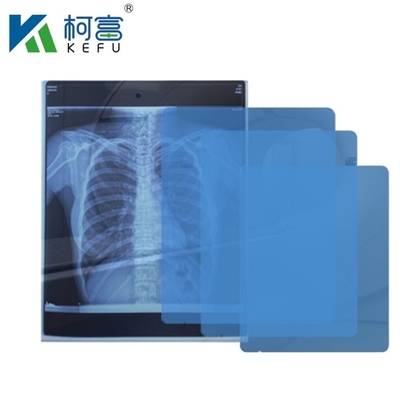 Imágenes médicas de alta definición CT DR Imágenes médicas de inyección de tinta de rayos X Película para mascotas 175mic 215mic Película de impresión azul transparente