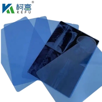 Impresión de película azul de inyección de tinta de rayos X de 8'*10' de hoja PET de inyección de tinta de película azul de película médica de rayos X seca