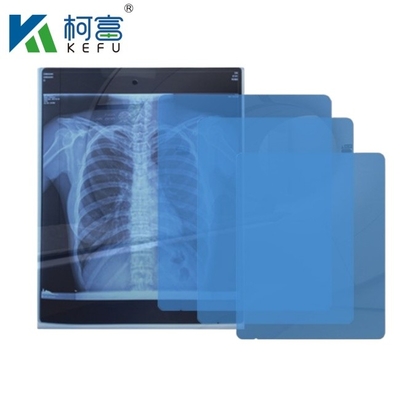 Tamaño personalizado Película médica de rayos X Azul Película médica sensible de rayos X Película médica de inyección de tinta