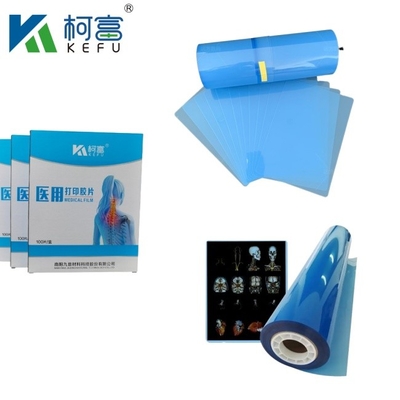 Película láser de alto contraste de inyección de tinta de película médica azul PET Película de rayos X para impresoras de inyección de tinta y láser