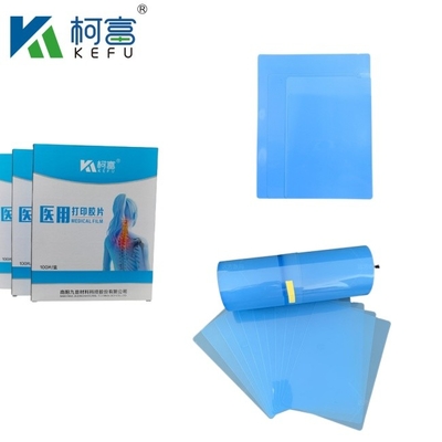 Película médica de rayos X Azul PET basada en rayos X Termal / película de inyección de tinta Imágenes médicas para clínicas y hospitales