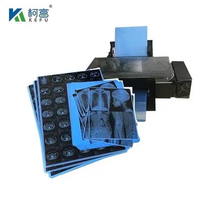 Película láser de grado médico optimizada para escaneo CT de múltiples rebanadas 16x20in 0.16mm de alta definición 3D - como imágenes