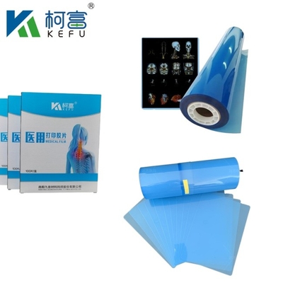 Película láser de alto contraste de inyección de tinta de película médica azul PET Película de rayos X para impresoras de inyección de tinta y láser