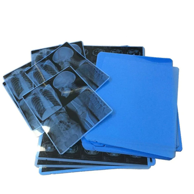 Película de rayos X azul médico para la impresión láser de diagnóstico preciso