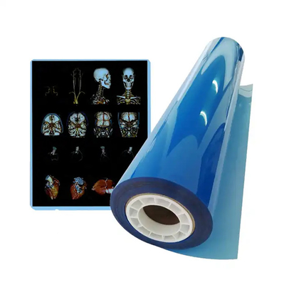 11*14 Tamaño de película de rayos X azul médico para impresión láser