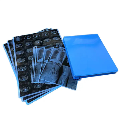 Disponible una película de rayos X de color azul médico para impresión láser producida profesionalmente