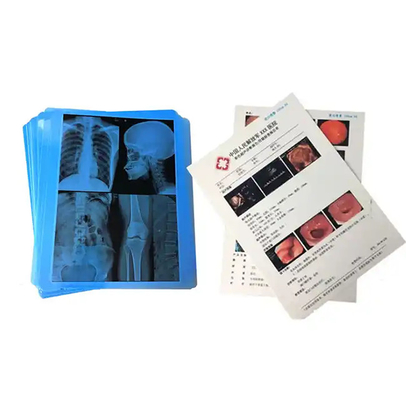 Película de rayos X de color azul médico para la impresión láser de artículos de consumo hospitalarios médicos