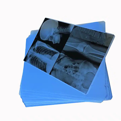 Película de rayos X de color azul médico para la impresión láser de artículos de consumo hospitalarios médicos