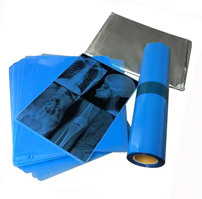 Película de rayos X de color azul médico para la impresión láser de artículos de consumo hospitalarios médicos