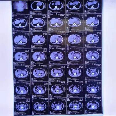 Costo razonable Películas de rayos X médicas con alta estabilidad de imagen que proporcionan imágenes de diagnóstico médico claras y precisas