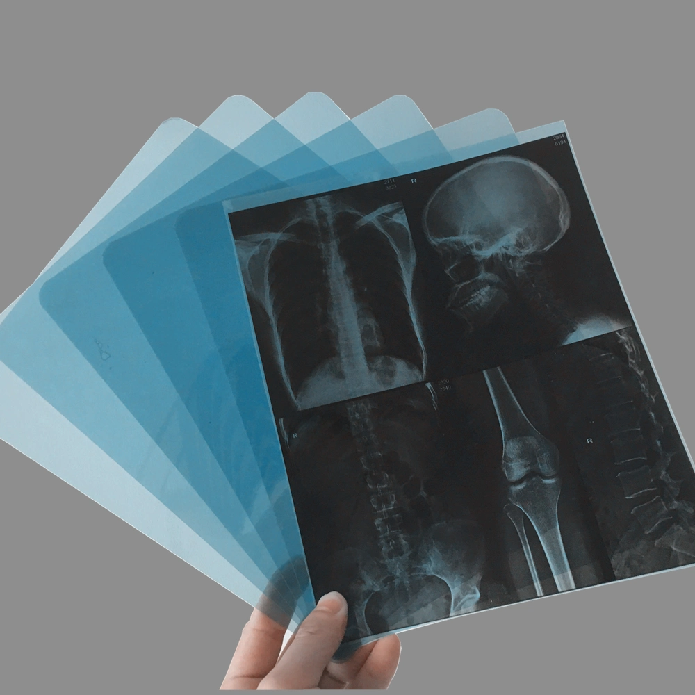 210 Microns X-ray Film Medical Inkjet & Laser for CT Dr Mr