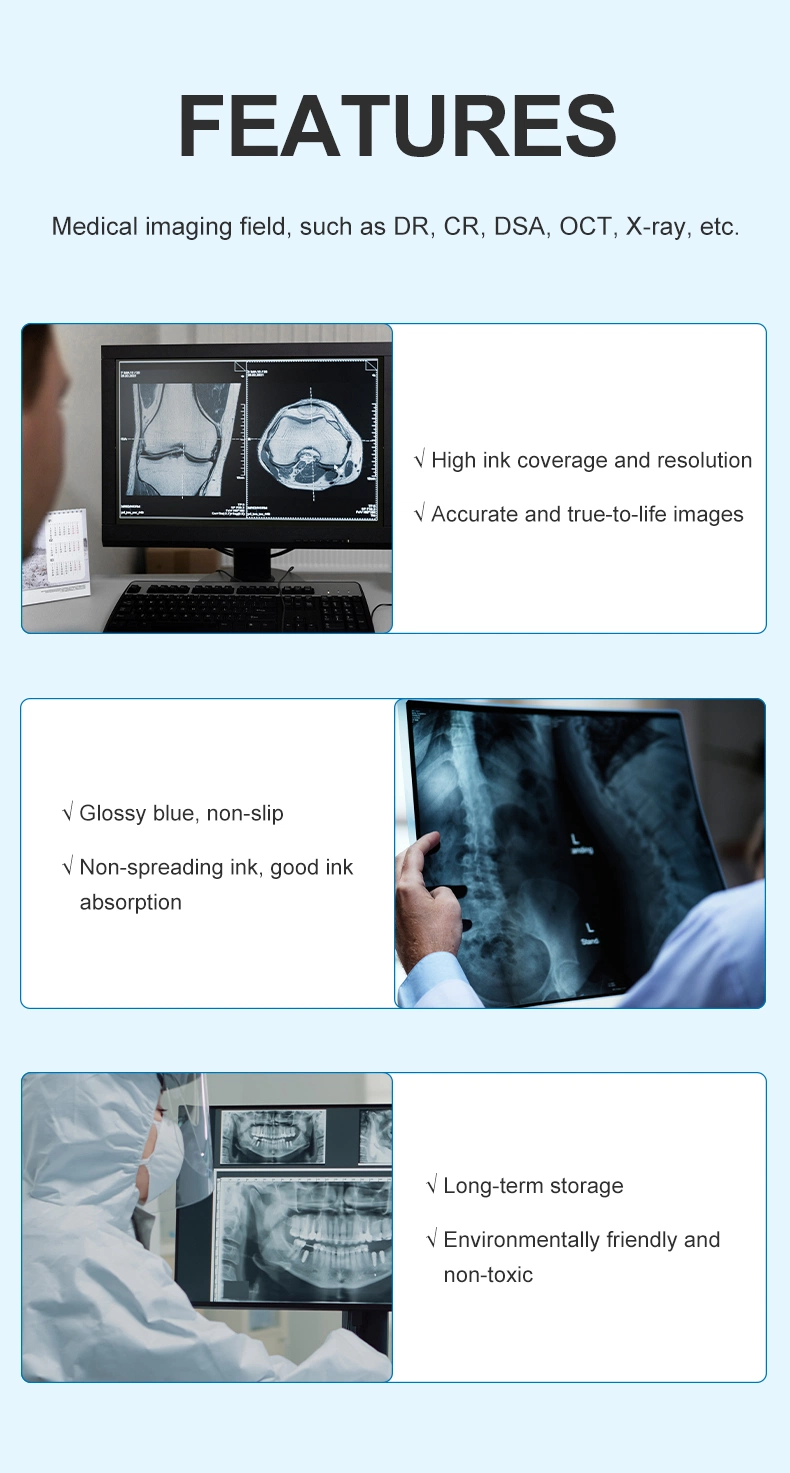 A3 A4 Medical Dry Laser Blue Base Inkjet Printable Pet X-ray Film