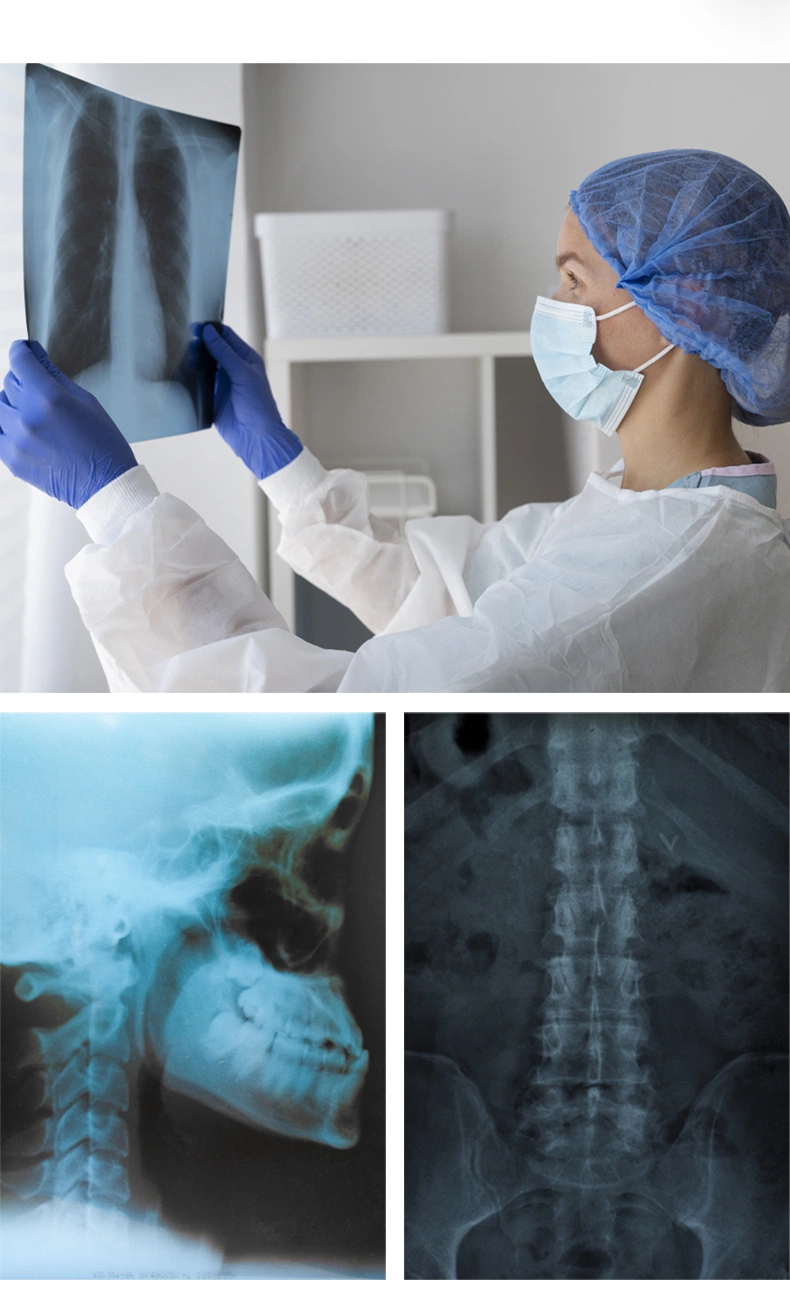 A3 A4 Medical Dry Laser Blue Base Inkjet Printable Pet X-ray Film