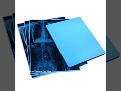 14*17 avanzan lentamente la película seca médica de la transparencia del chorro de tinta de la película de los 35x43cm Fuji para la impresión de la pantalla